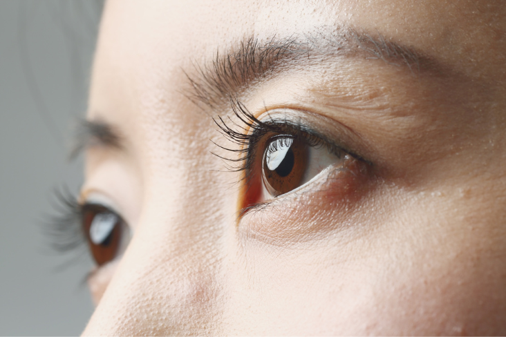 Eye exam